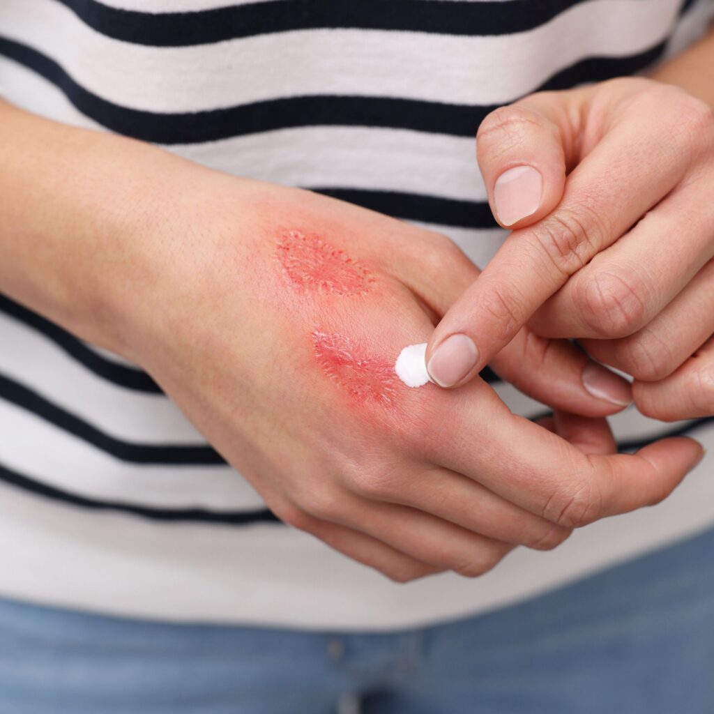 Niedobór witaminy C wpływ na skórę